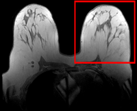 this is the moving image. The transform is calculated by matching this to the reference image