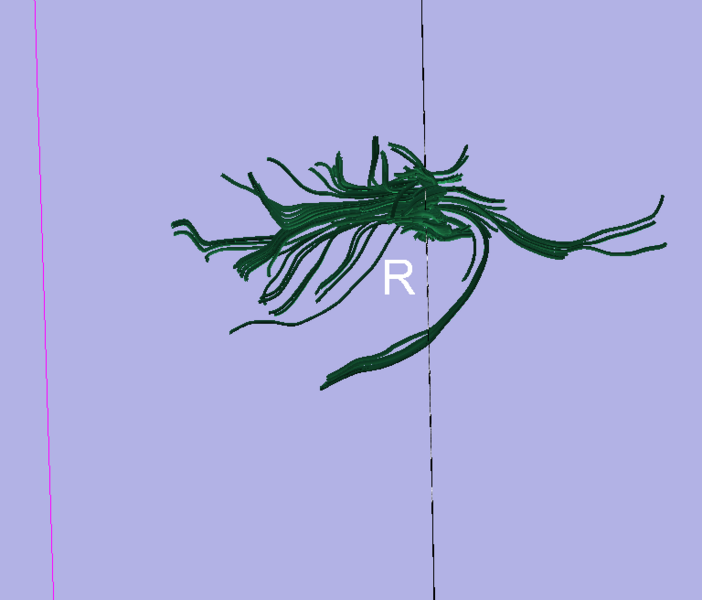 File:Smoothing 17 fibertrac.png