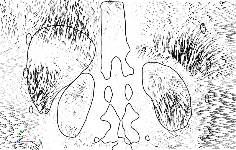 File:Respiratory anisotropicGlyphs.png