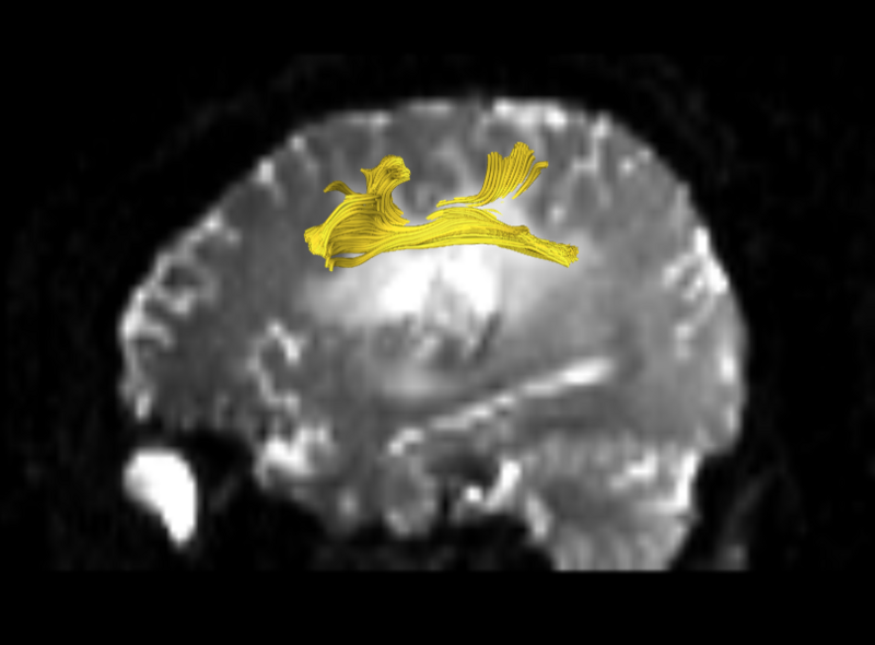 File:1224 wb default single left.png