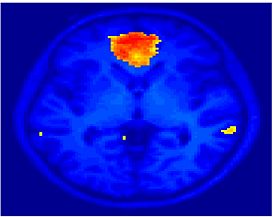 Mit fmri clustering KM 5Double.jpeg