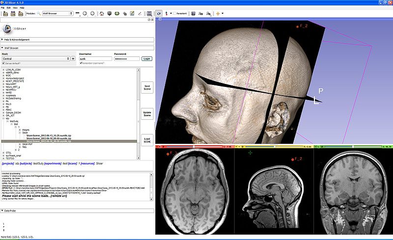 File:XNATSlicerScreenshot2 6-12.JPG