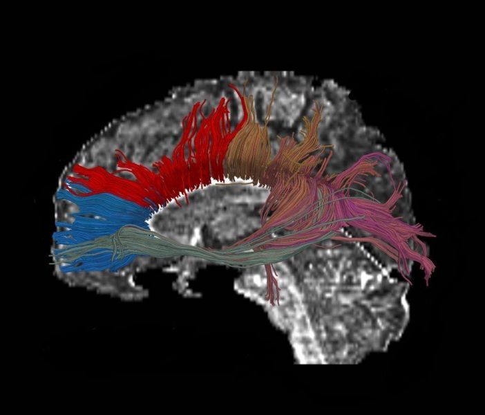 File:Clustering corpus.jpg