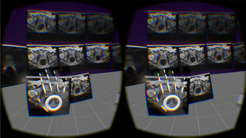 File:ProstateVR1.png