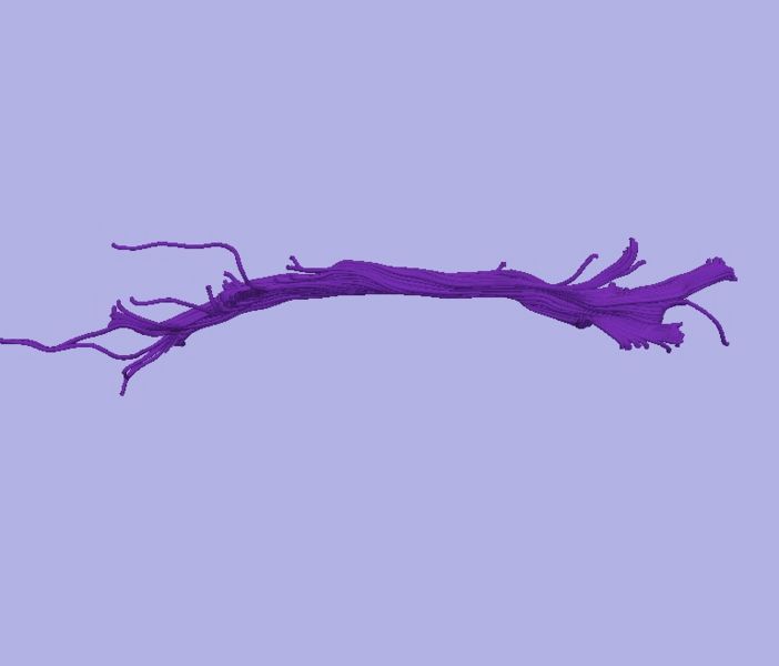 File:CaseD0688 L dil7 sens60.jpg