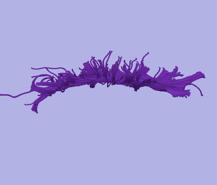 File:CaseD0688 L dil5 sens1.jpg