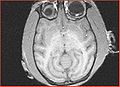 Thumbnail for version as of 23:58, 7 October 2009