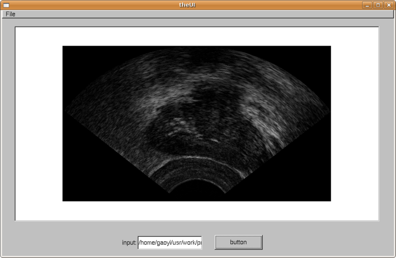 File:UI prostate.png