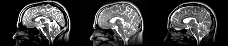 File:53-31 RI affine.png