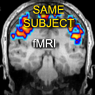 Registration HLogo IntrafMRI.png