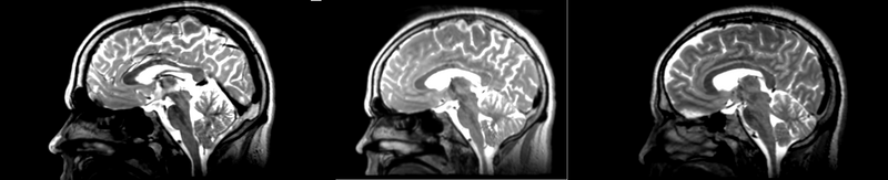 File:53-31 RI bspline.png