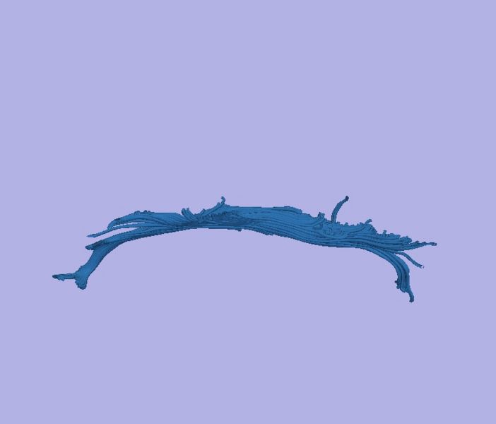 File:CaseD00724 L dil0 sens40.jpg