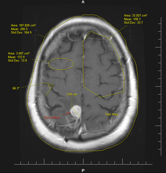 File:ClearCanvas markups demo.jpg