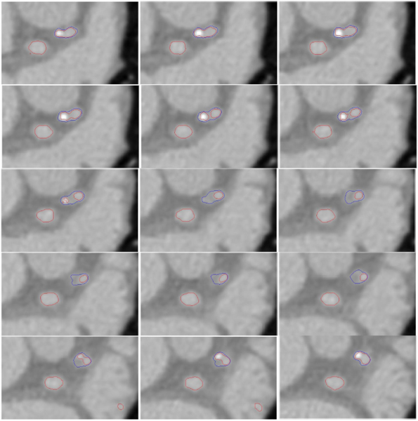 File:Ponnappan Plaque 3D.PNG