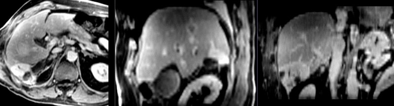 File:RegLib C13 MRT1-CT BSpline.gif