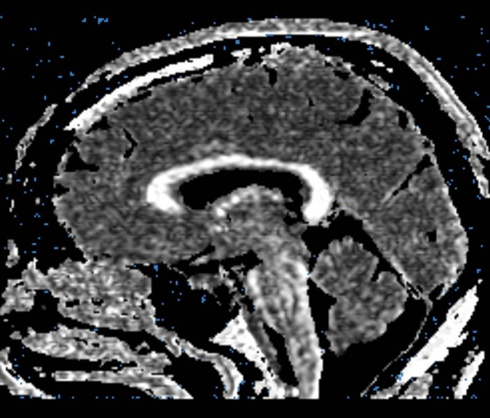 File:CaseD00724 B2.jpg