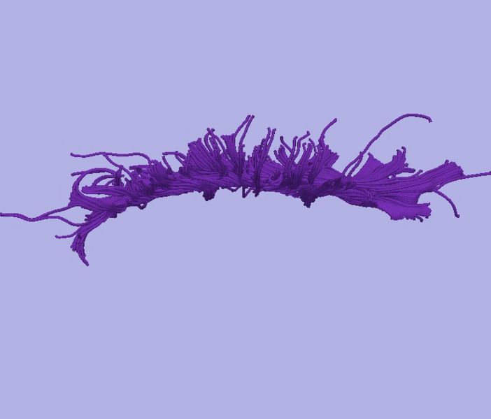 File:CaseD0688 L dil7 sens1.jpg