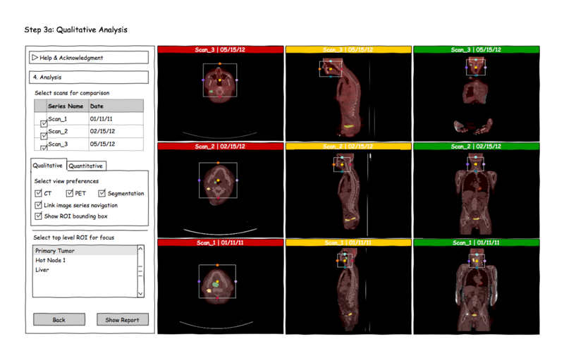 File:Long PETCT Qualitative.png