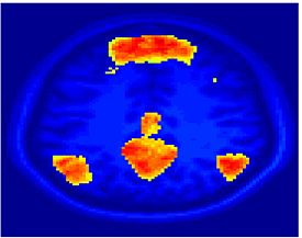 Mit fmri clustering SC 5Clust 2.jpeg