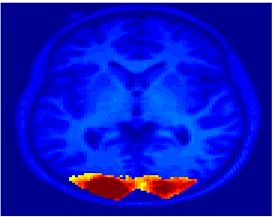 Mit fmri clustering Seed V1.jpeg