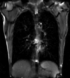 RegLib 46: 2D Cine MRI of breathing cycle