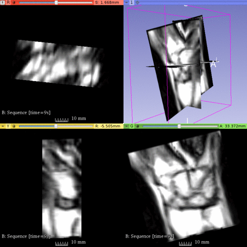 Wrist multivolume.gif