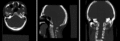 Head&Neck reg Anim.gif
