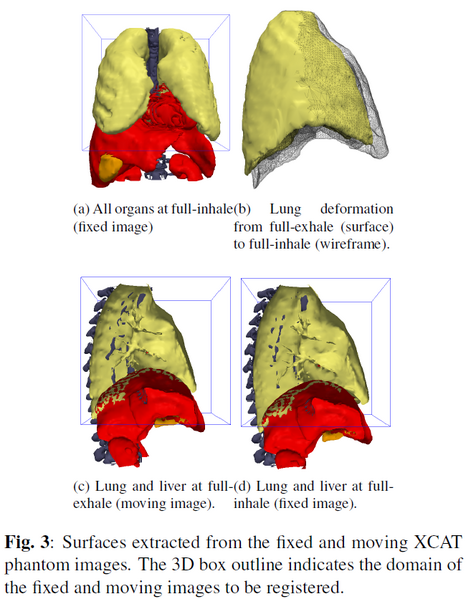 File:SlidingOrganRegistration XCATimages.png