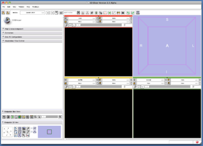 TryVersion2 SlicerOpenIGTLink.png