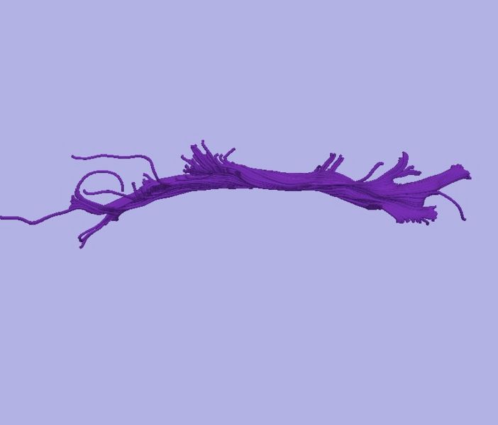 File:CaseD0688 L dil5 sens40.jpg