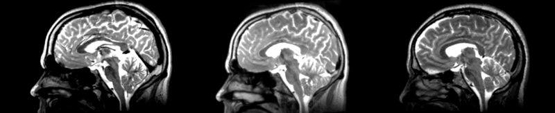 File:53-31 affine.png