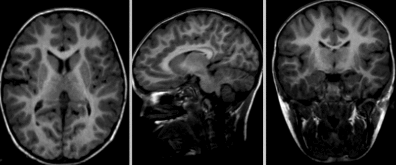 File:RegLib C42 Xf2 registered.gif