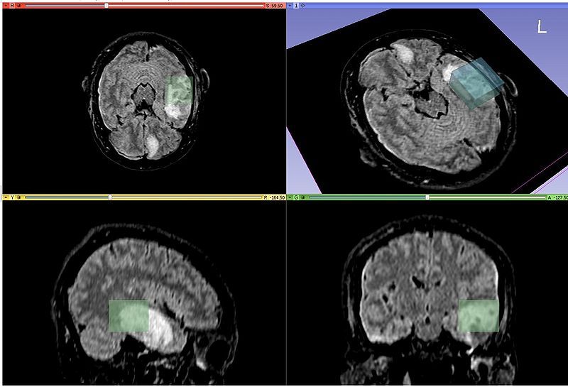 File:AcSeg initial box.jpg