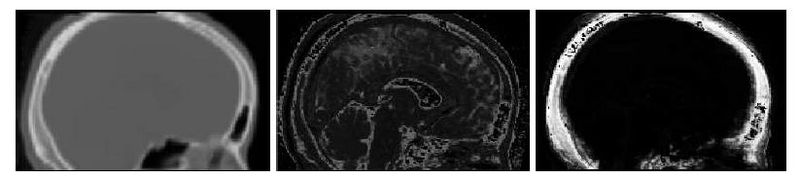 File:Bone air seg.jpg