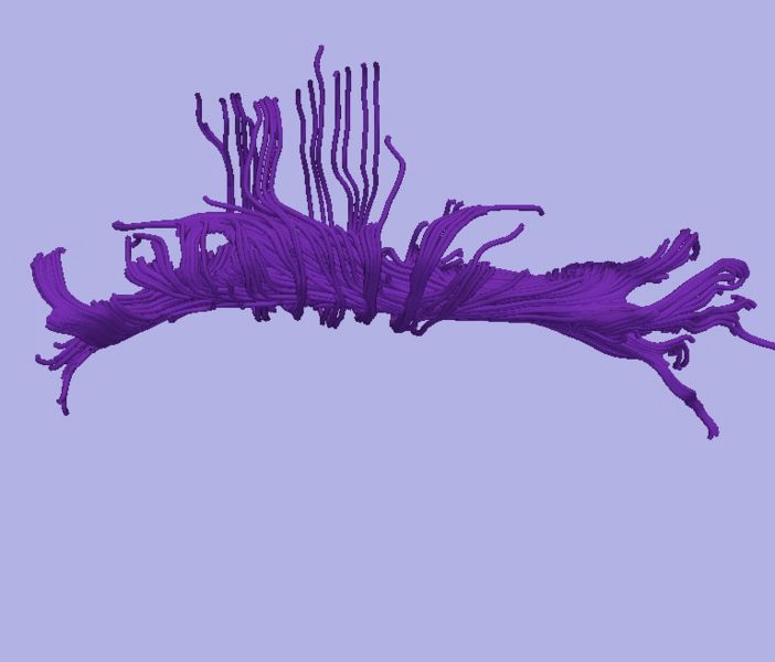 File:CaseD0608 L dil3 sens1.jpg