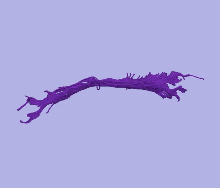 File:CaseD116 L dil7 sens60.jpg