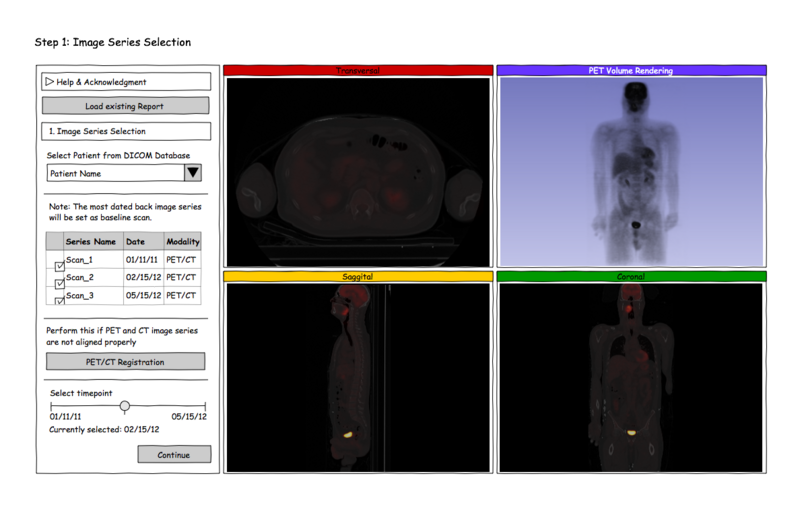 File:Long PETCT ImageSeriesSelection.png