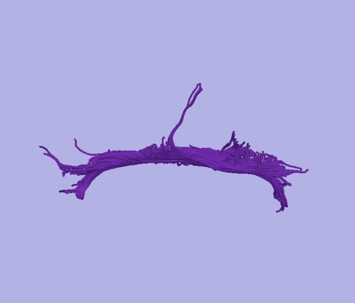 File:CaseD00724 L dil9 sens20.jpg