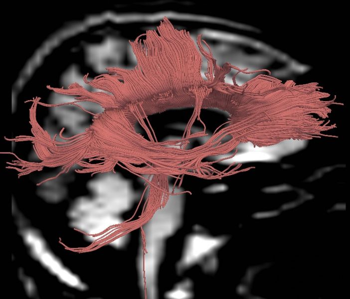 File:CaseD00724 R blur10.jpg