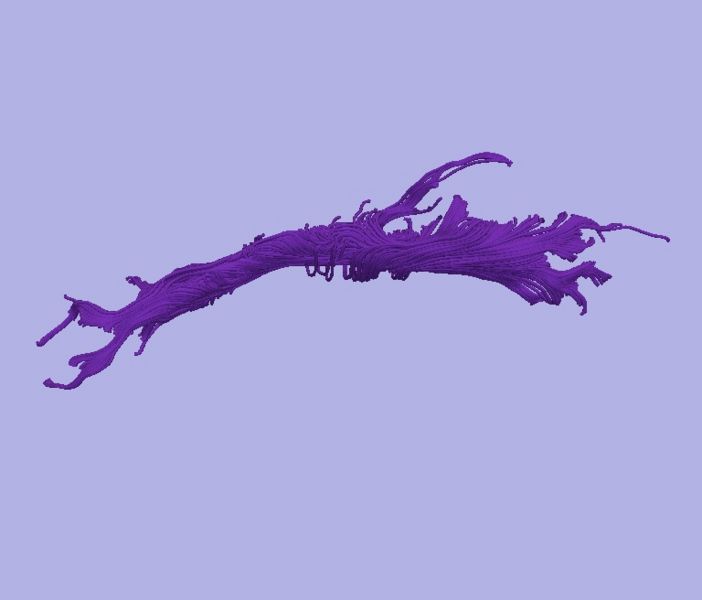 File:CaseD116 L dil3 sens20.jpg