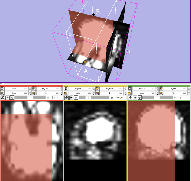 File:Projects-ARRA-SlicerEM-Developer-EMSegment step10 3DView.png