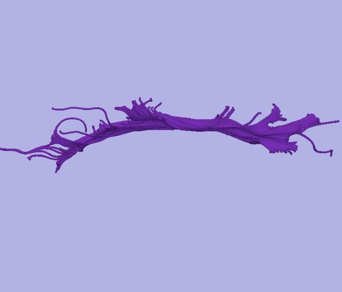 File:CaseD0688 L dil9 sens40.jpg