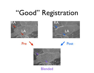 Good Registration CARMA.png