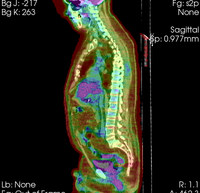 this is the fixed reference image. All images are aligned into this space