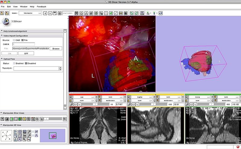 File:SlicerOpenCV VideoImporter Demo.jpg