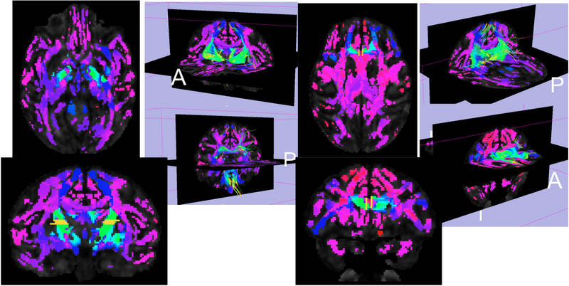 File:UNC GraphbasedConnectivity Monkeycombined.png
