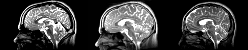 File:53-31 rigid.png