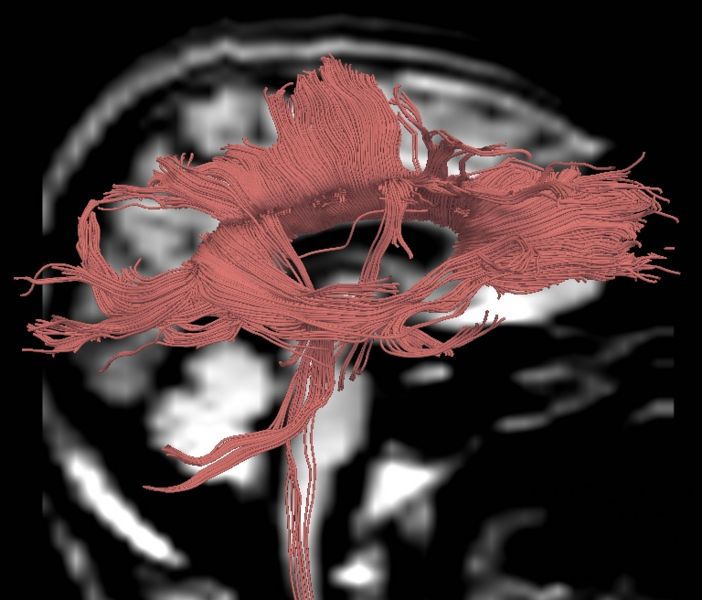 File:CaseD00724 R blur15.jpg