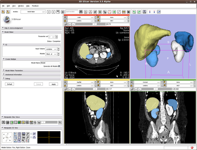 File:RobustStatisticsSegmentation LiverSpleenKidney.png