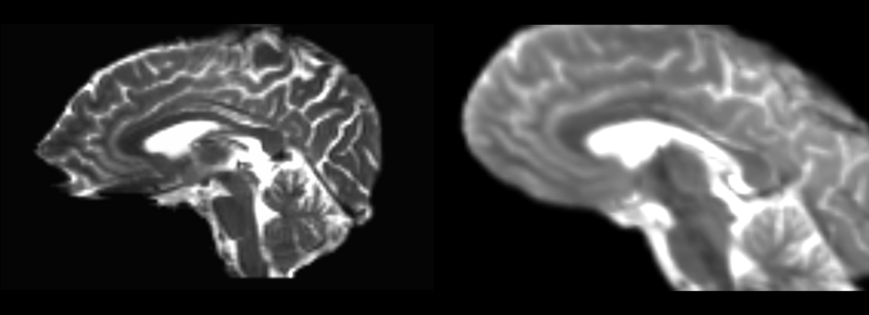 File:T2-base masked rigid-linear-affine.png